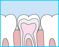 sealants